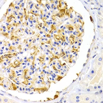 LEPR / Leptin Receptor Antibody