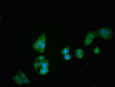 DPP4 / CD26 Antibody