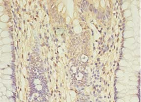 AGBL2 / CCP2 Antibody