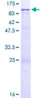 Human ITGB7 / Integrin Beta 7 Protein (Recombinant GST)