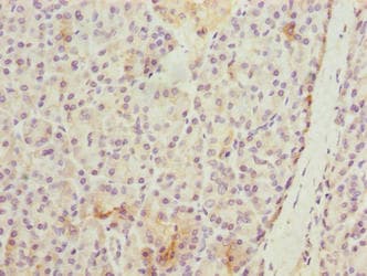 Polyclonal Rabbit anti-Human WDR74 Antibody (IHC, WB)