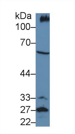 PODXL / Podocalyxin Antibody (aa171-404)