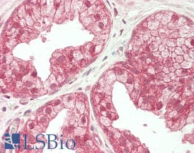 Polyclonal Rabbit anti-Human GATC Antibody (IHC, WB)