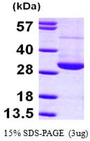 Human RAN Protein (Recombinant His)