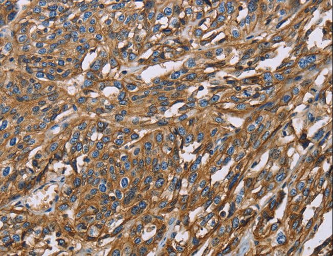 Basigin / Emmprin / CD147 Antibody