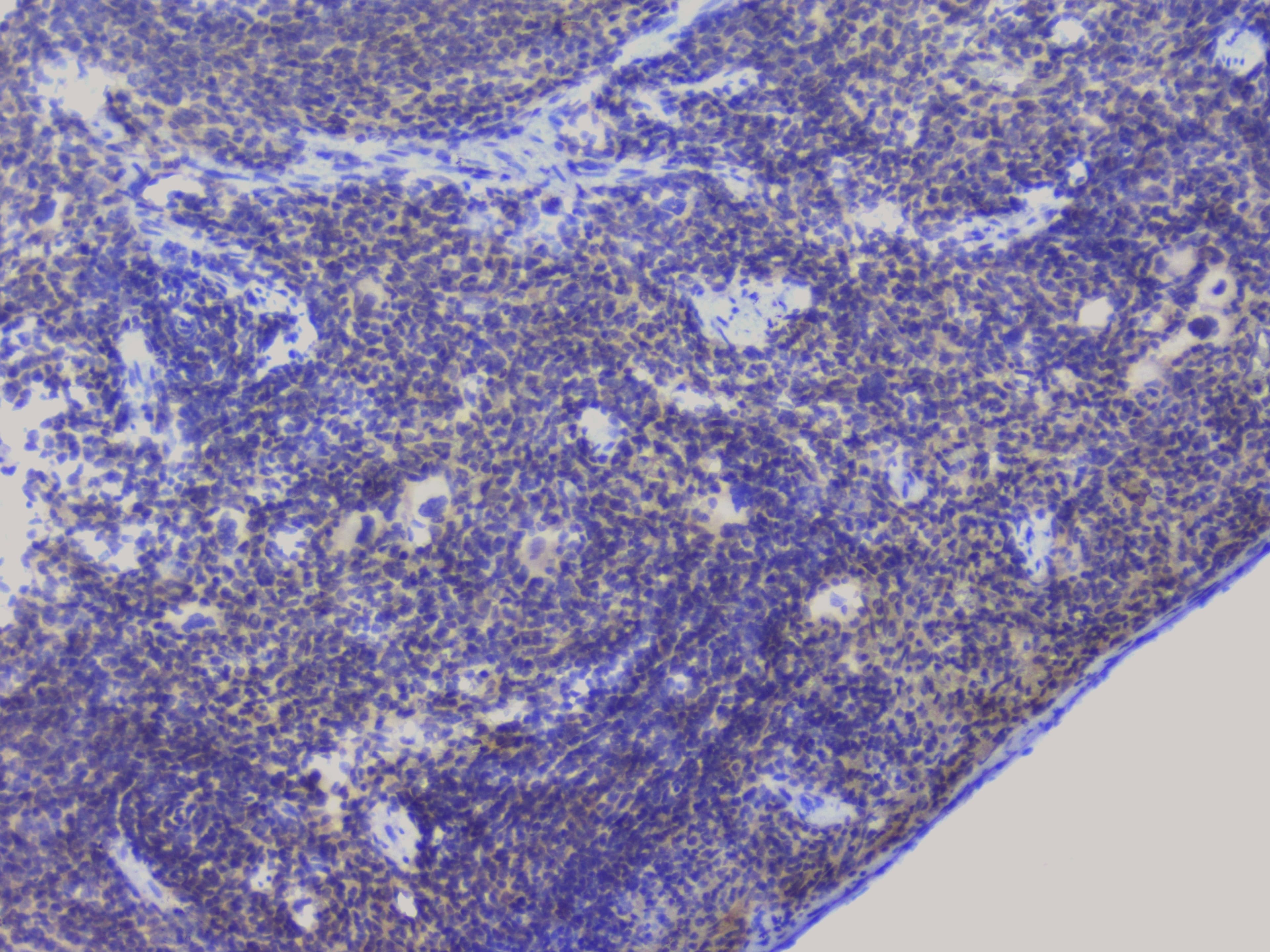 NRF1 / NRF-1 Antibody