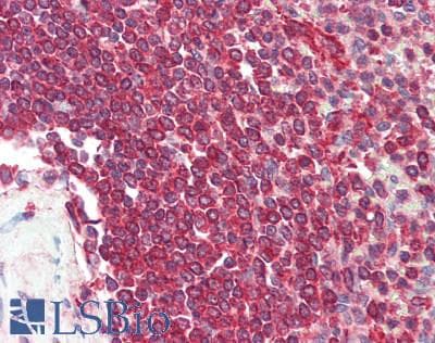 YKL39 / CHI3L2 Antibody