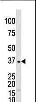 GALK1 / GK1 Antibody (aa345-375)