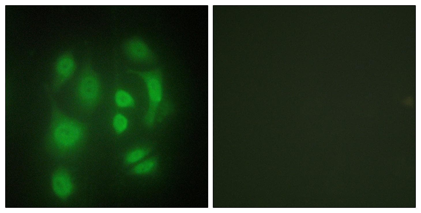 SYNCRIP / HnRNP Q Antibody