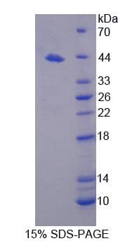 Human WC1 / ATP7B Protein (Recombinant His-T7)