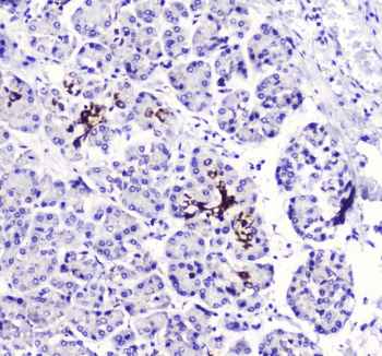 BTC / Betacellulin Antibody