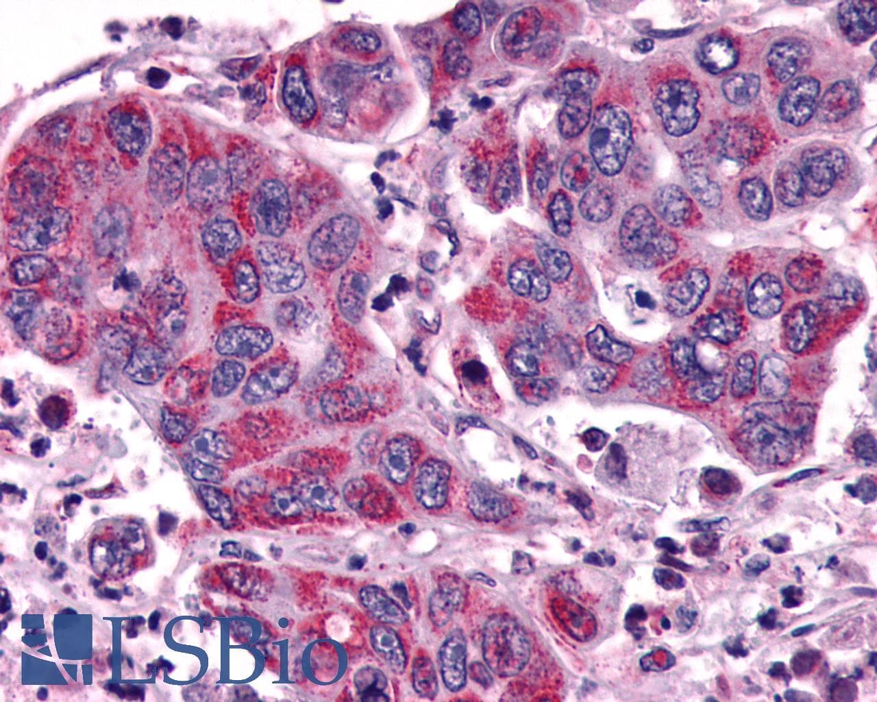 PathPlus™ Polyclonal Rabbit anti-Human ACKR3 / CXCR7 Antibody (Cytoplasmic Domain, IHC, WB)