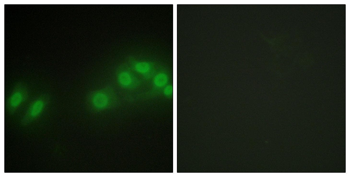 LATS2 Antibody