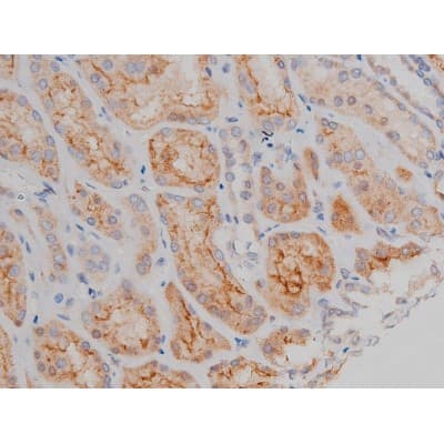 SNCA / Alpha-Synuclein Antibody (phospho-Ser129)