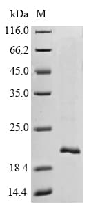 Crab-eating macaque TTR / Transthyretin Protein (Recombinant 6His, N-terminus)