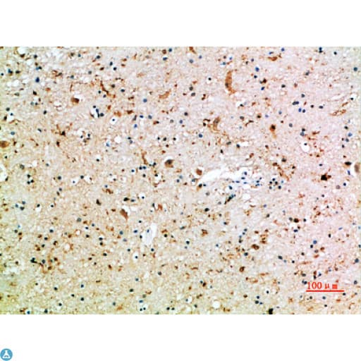 CD16 Antibody