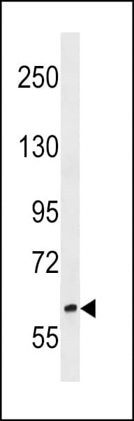 RREB1 Antibody (aa1398-1424)