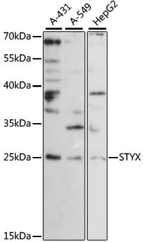 Polyclonal Rabbit anti-Human STYX Antibody (WB)