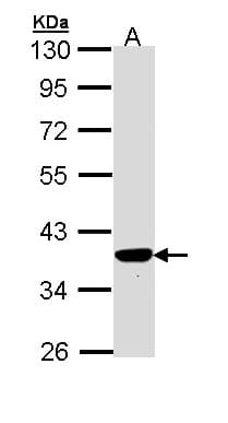 TP53I3 / PIG3 Antibody (aa1-332)