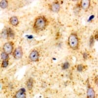 Polyclonal Rabbit anti-Human DNAM-1 / CD226 Antibody (C-Terminus, IHC, IF, WB)