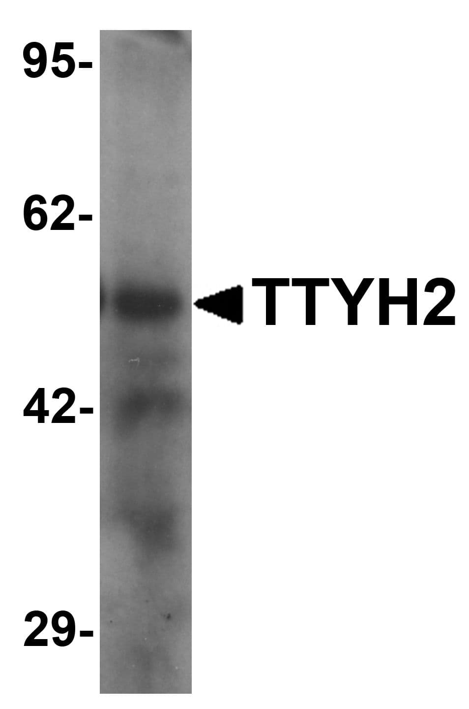 IHC-plus™ Polyclonal Rabbit anti-Human TTYH2 Antibody (IHC, IF, WB)