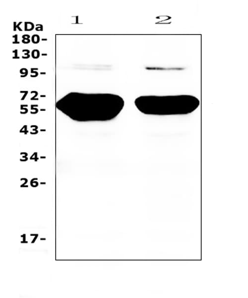 Polyclonal Rabbit anti-Human AMY1A + AMY1B + AMY1 Antibody (IHC, WB)