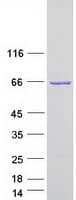 Human PLS1 / Fimbrin Protein (Recombinant Myc-DDK (Flag))