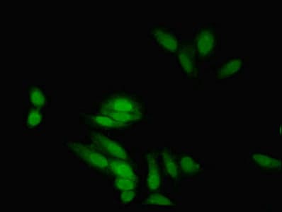 EIF5A2 Antibody