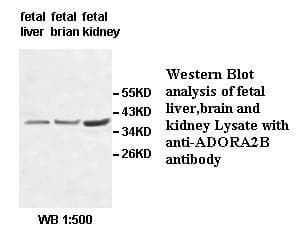 Polyclonal Rabbit anti-Human ADORA2B/Adenosine A2B Receptor Antibody (WB)