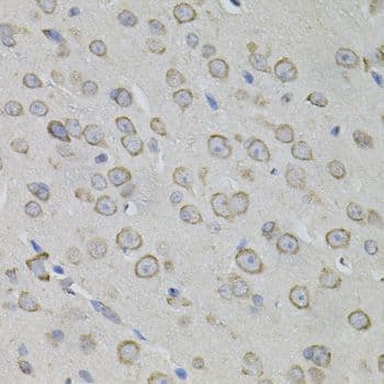 MYO10 / Myosin-X Antibody