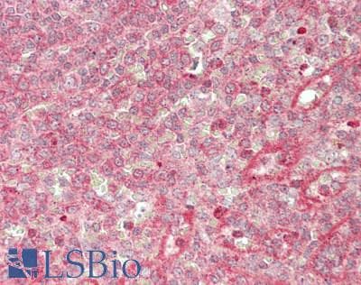 PathPlus™ Polyclonal Rabbit anti-Human ACVR2 / ACVR2A Antibody (aa45-305, IHC, WB)