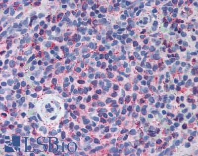 Polyclonal Rabbit anti-Human ADAM8 Antibody (aa371-587, IHC, WB)