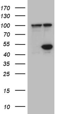 HDAC8 Antibody (aa1-243, clone OTI1A4, Carrier-free)