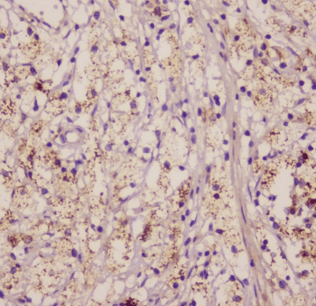 EML4 Antibody