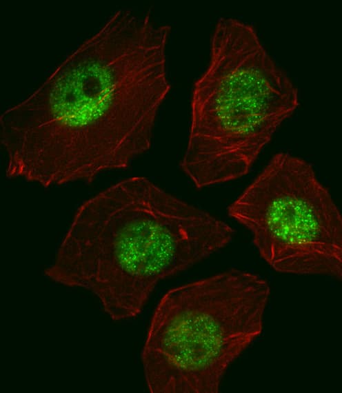 SOX2 Antibody (clone 57CT23.3.4)
