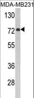 FMO3 Antibody (aa30-56)