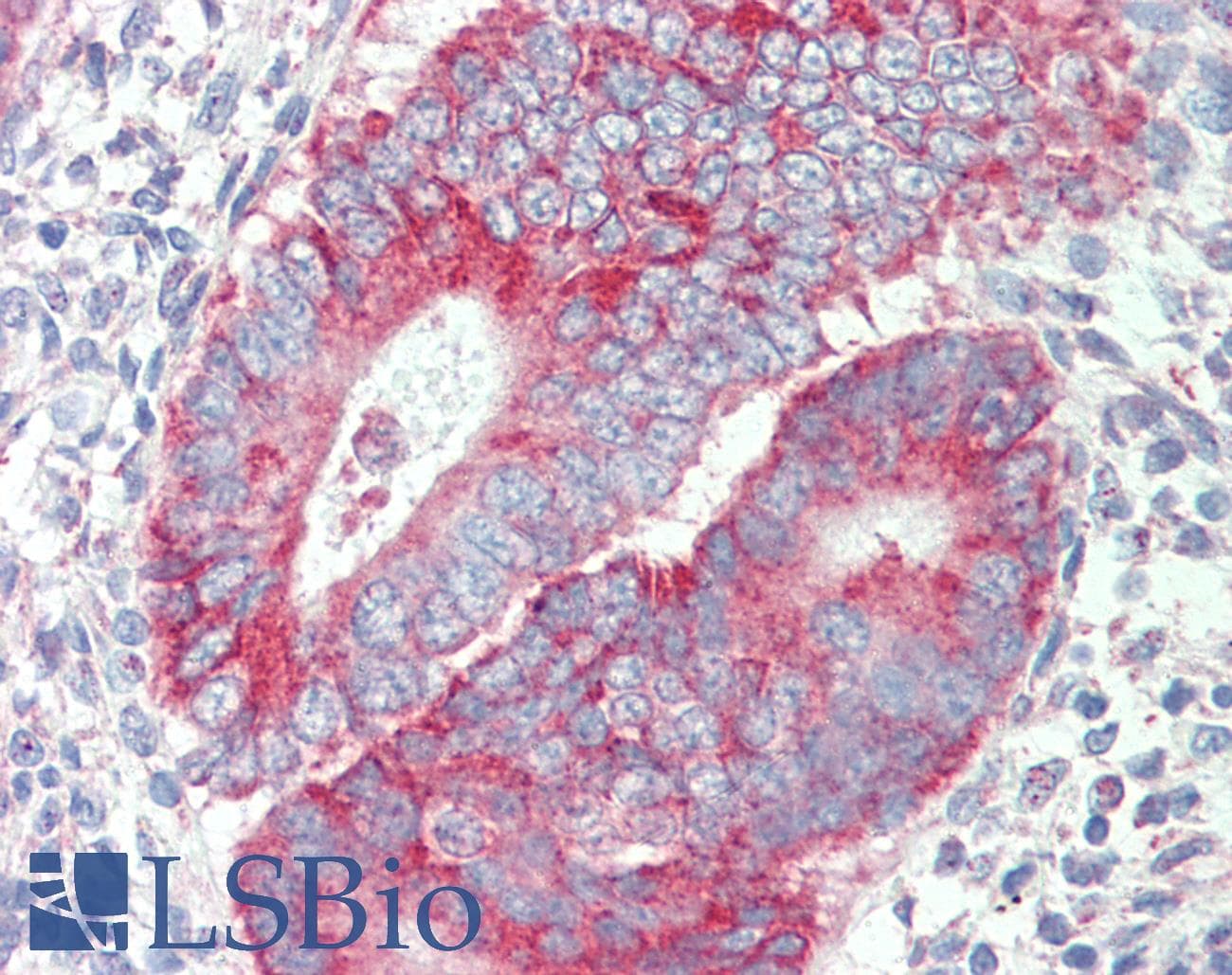 IHC-plus™ P2RX4 / P2X4 Antibody (aa56-69)