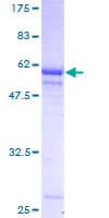 Human PIH1D1 Protein (Recombinant GST)