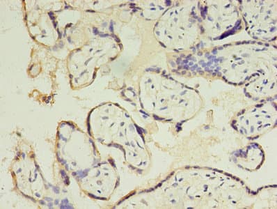CSHL1 / CSH-Like 1 Antibody (aa1-128)