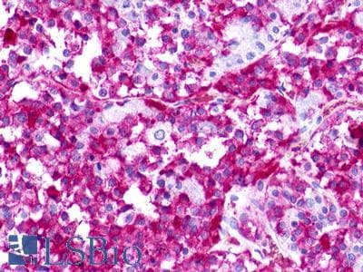 PathPlus™ Polyclonal Rabbit anti-Human GPR176 Antibody (C-Terminus, IHC)