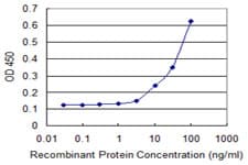 Monoclonal Mouse anti-Human FANCB / FAB Antibody (clone 2B10, WB)