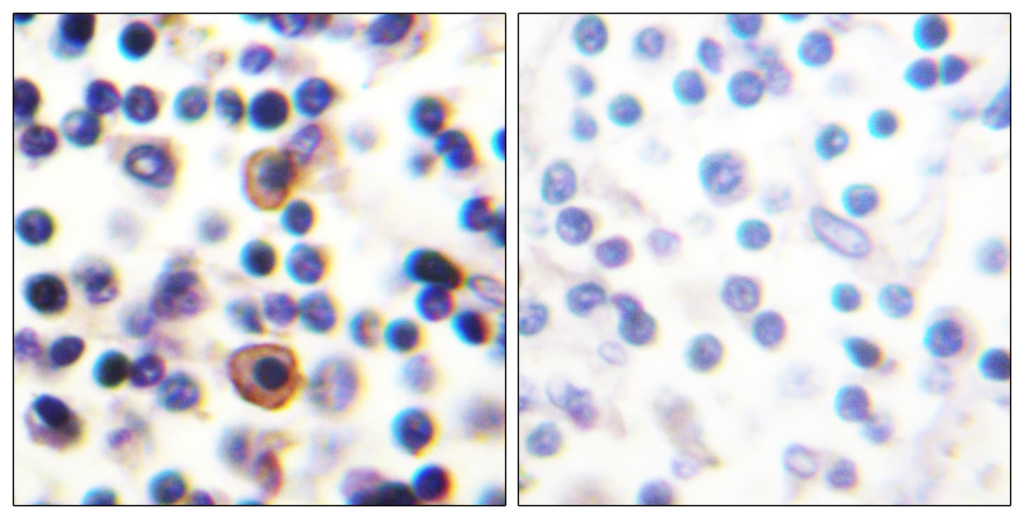IL9R / CD129 Antibody (phospho-Ser519)