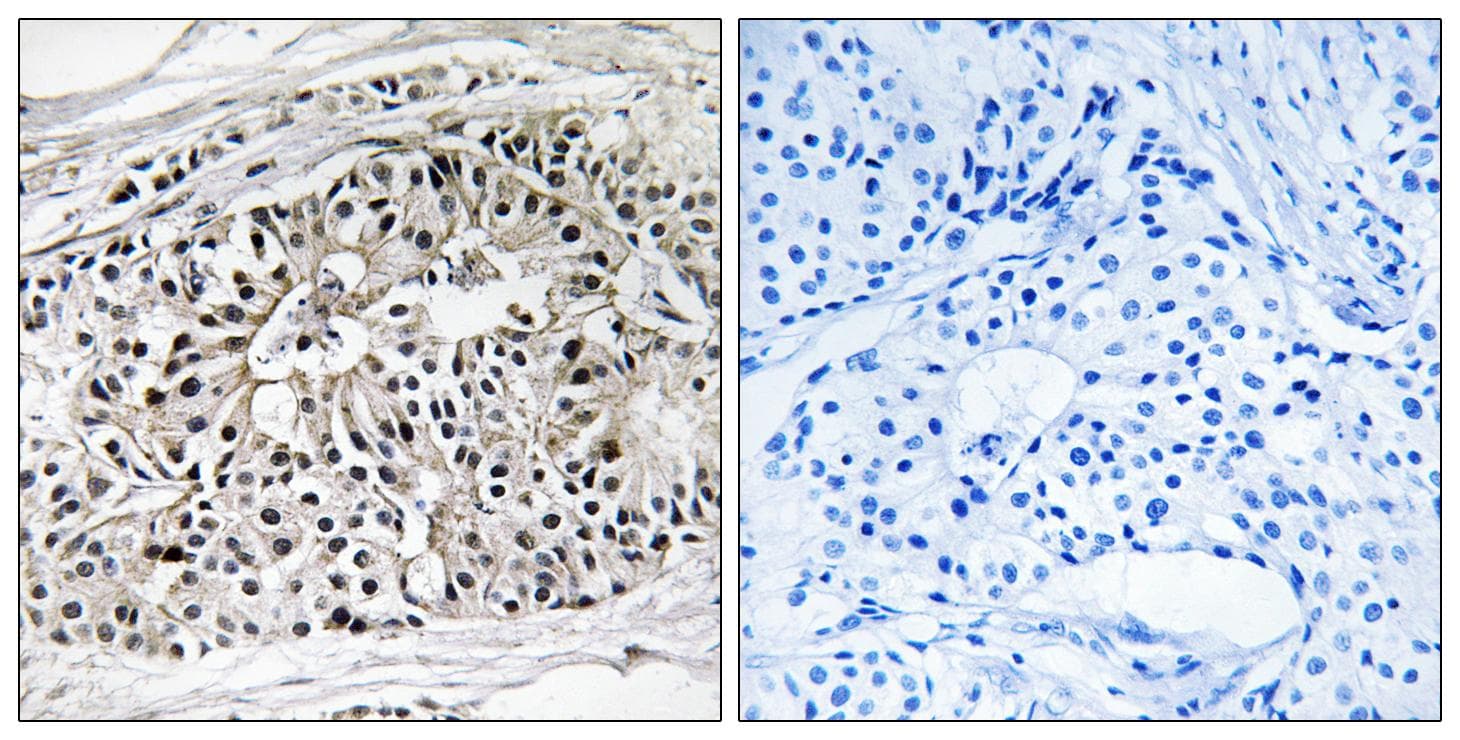 EHHADH / Enoyl-Coa Hydratase Antibody