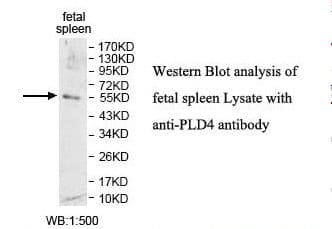 PLD4 / Phospholipase D4 Antibody (aa135-423)