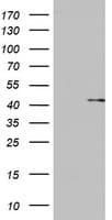 Monoclonal Mouse anti-Human OTC Antibody (clone OTI5E4, aa33-354, WB)