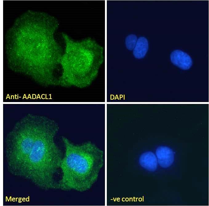 Polyclonal Goat anti-Human NCEH1 / AADACL1 Antibody (aa403-415, IF)