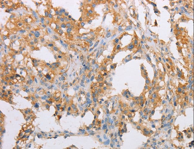 ACTR2 / ARP2 Antibody