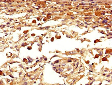 Polyclonal Rabbit anti-Human Eomesodermin / EOMES Antibody (IHC, WB)