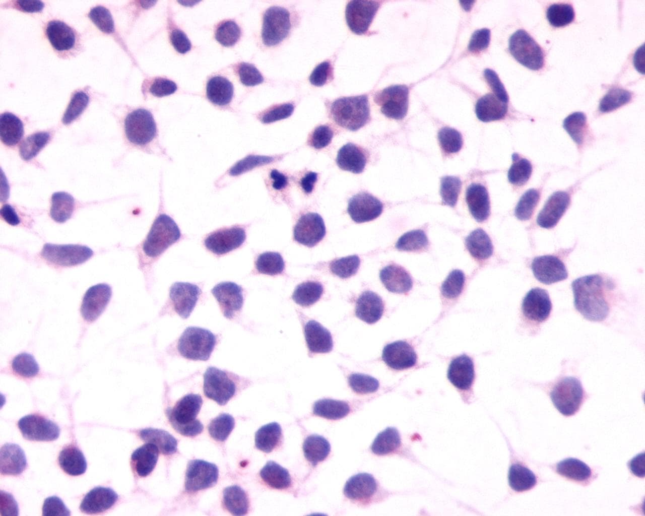 PathPlus™ Polyclonal Rabbit anti-Human CNR1 / CB1 Antibody (Cytoplasmic Domain, IHC)