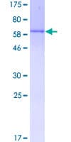 Human DUSP4 / MKP2 Protein (Recombinant GST)